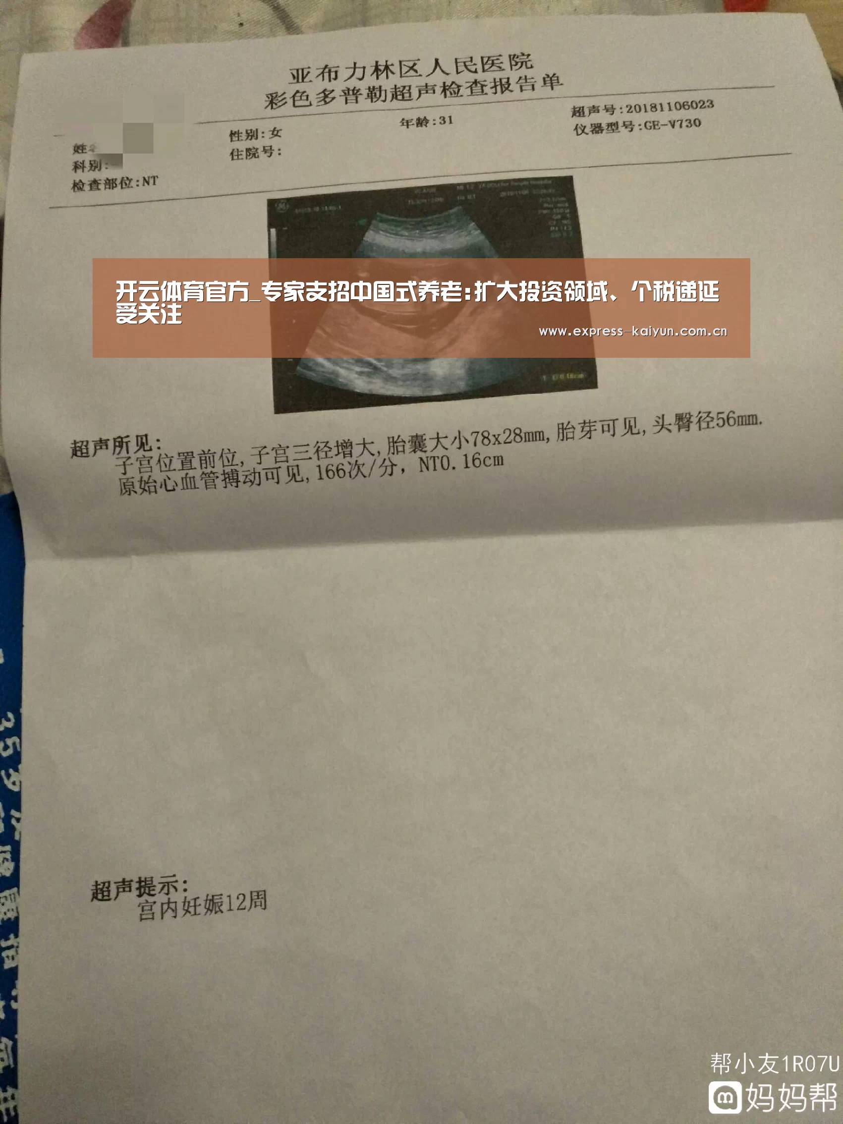 开云体育官方_专家支招中国式养老:扩大投资领域、个税递延受关注(图1) 开云体育官网